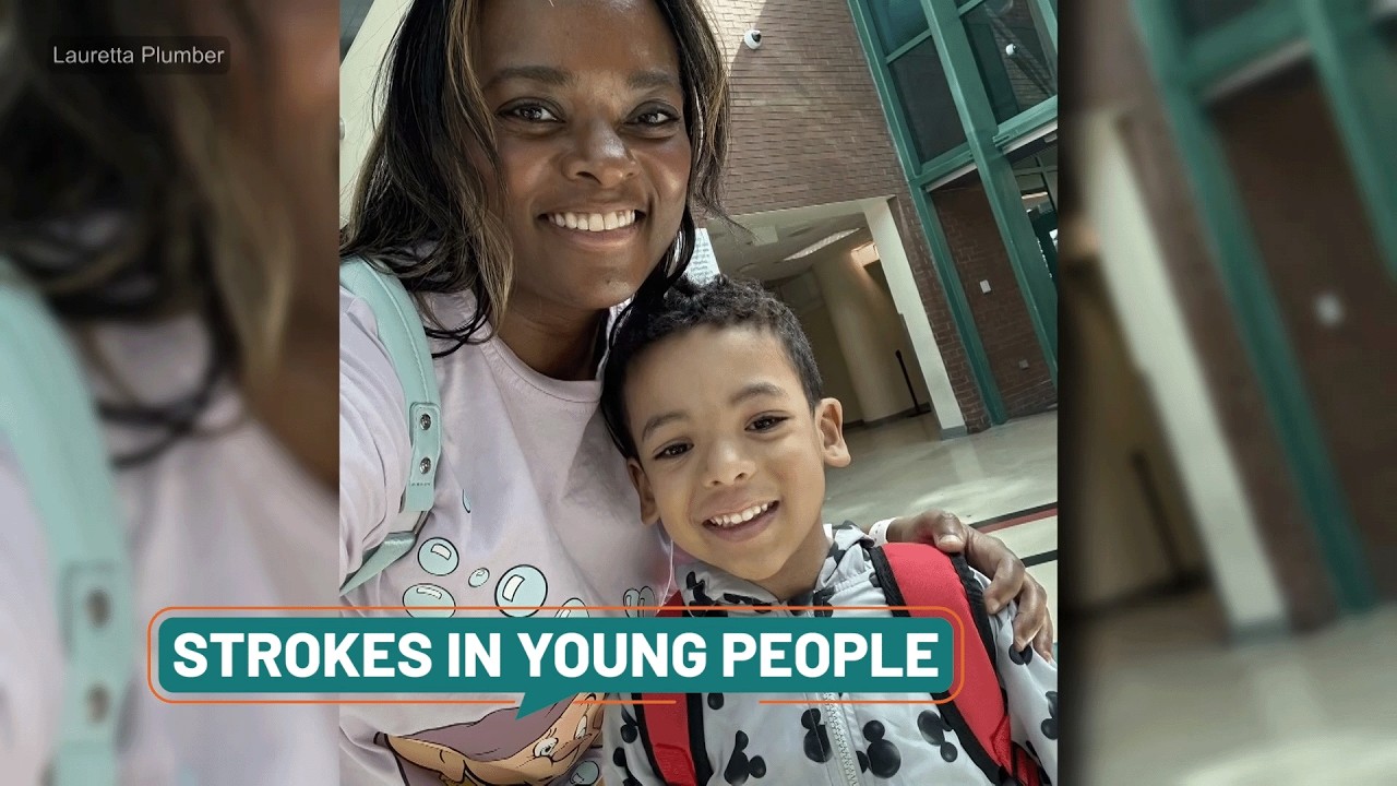 Strokes Rising Among Adults Under 45
