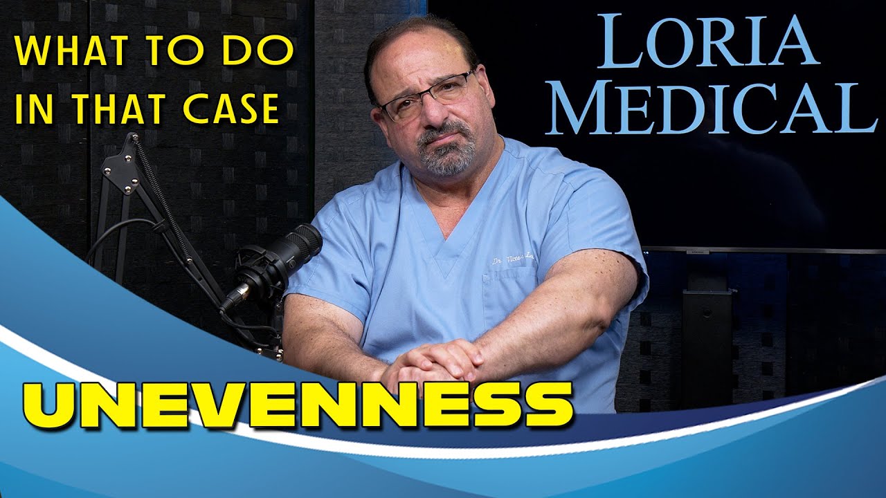 Unevenness? | Filler Procedures.