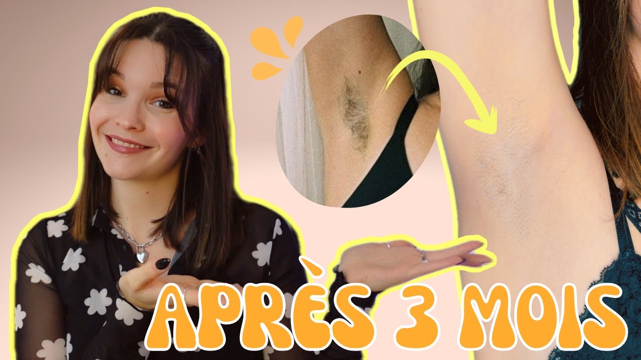 Épilateur à lumière pulsée Silk Expert Pro 5 : UN MIRACLE !