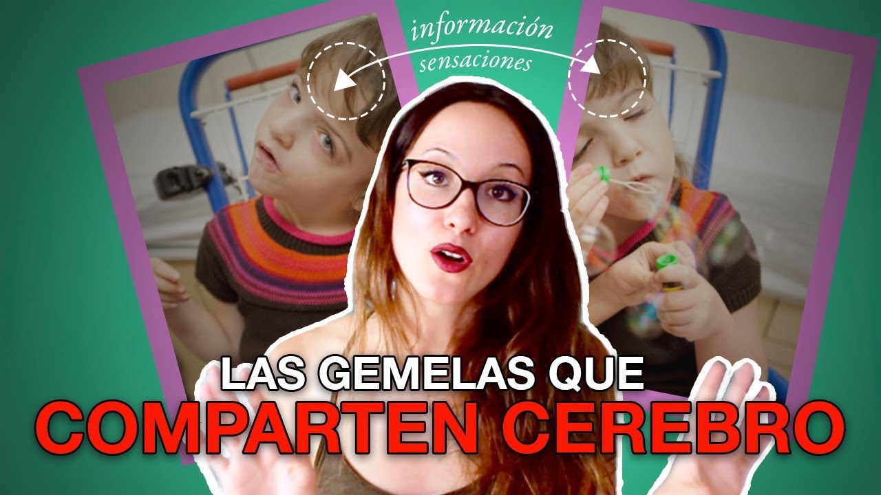 LAS GEMELAS QUE COMPARTEN CEREBRO | Tatiana y Krista Hogan