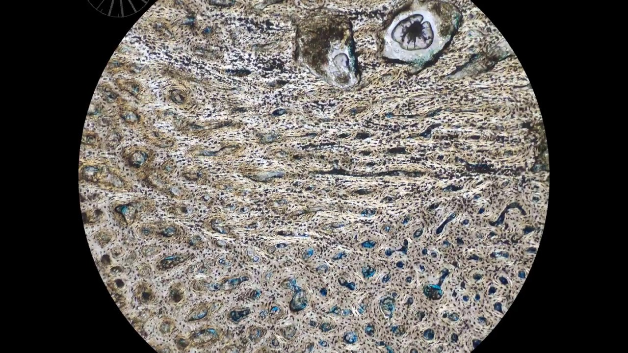 Chicken bone between crossed polarizers (01)