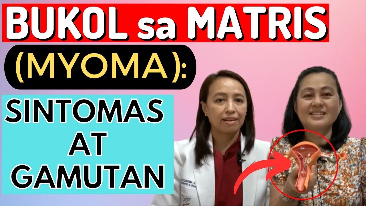 BUKOL sa MATRIS (Myoma) : Sintomas at Gamutan - By Doc Sharon Mendoza (OB-Gyne) and Doc Liza Ong