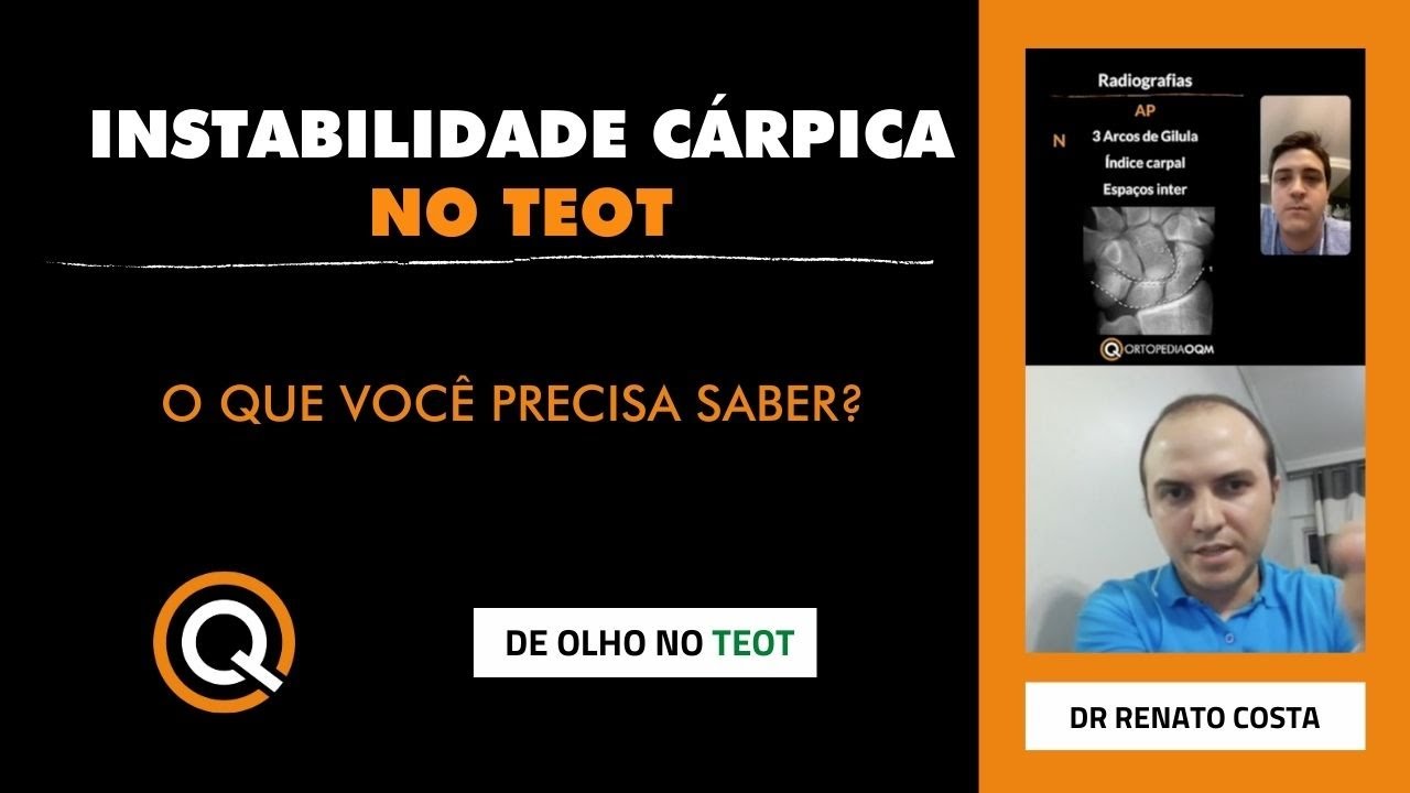 Instabilidade Cárpica no TEOT!👊🏻  Reta Final SBOT (OrtopediaOQM c/ Dr Renato Costa!)
