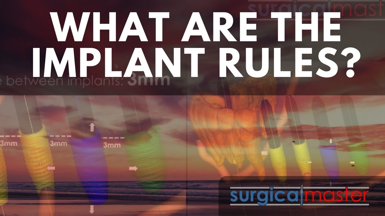 What are the rules for placing implants?