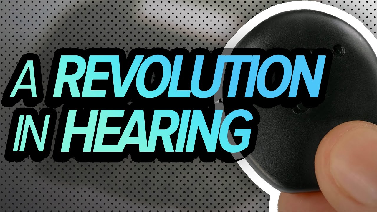 How the Kanso 2® Sound Processor revolutionizes hearing: Interview with a cochlear implant recipient