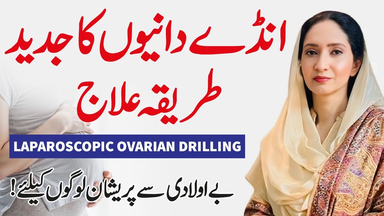 Ovarian Drilling for PCOS: Benefits, Purpose & Fertility Outcome | Muhammad Hospital
