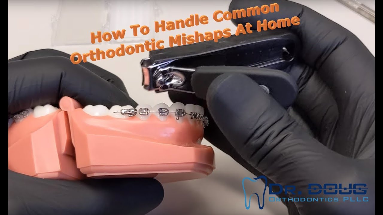 How to handle orthodontic emergencies at home