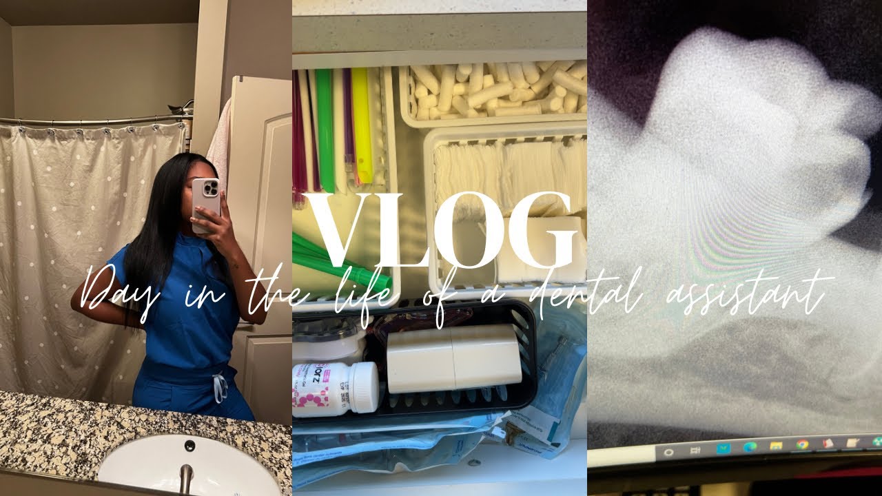 Day in the life of a lead dental assistant | lead assistant duties | our office broke down?
