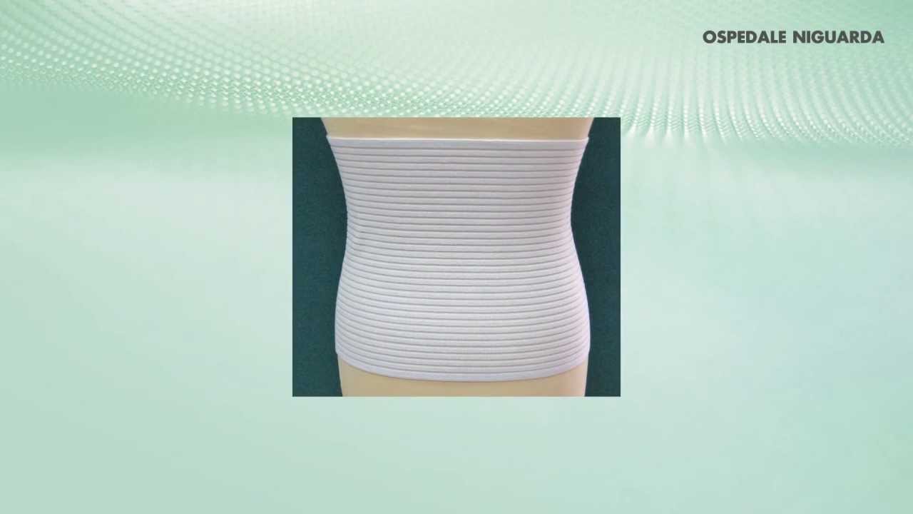 Laparoplastica open