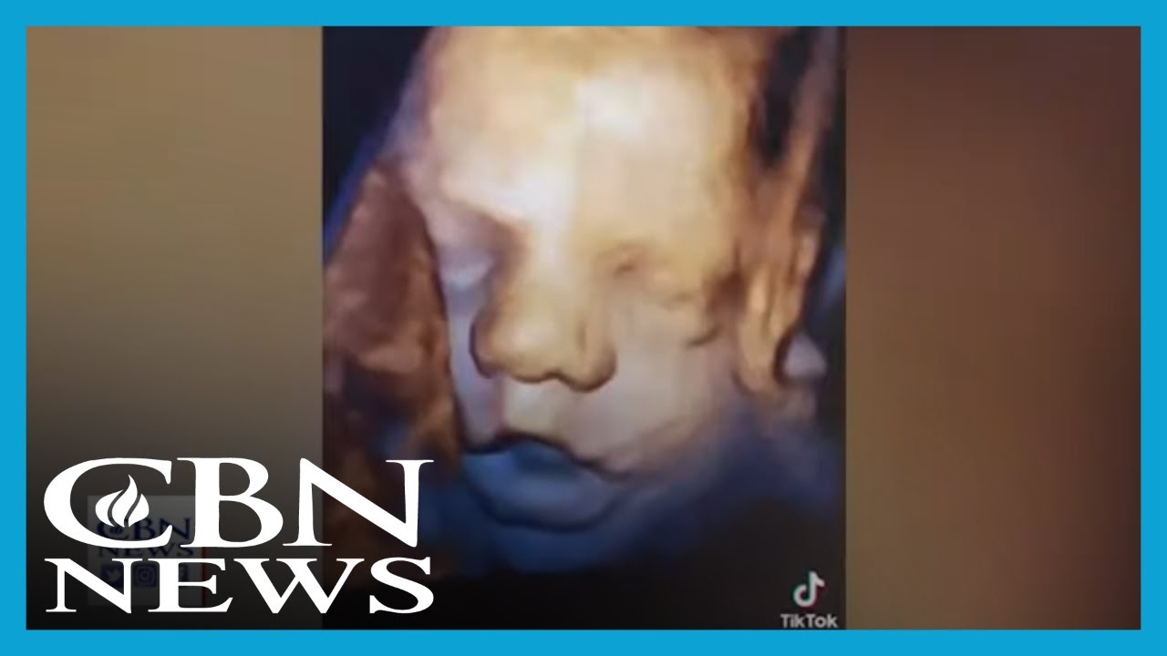 These Powerful Ultrasound Images May Be Key to Defeating Roe v. Wade