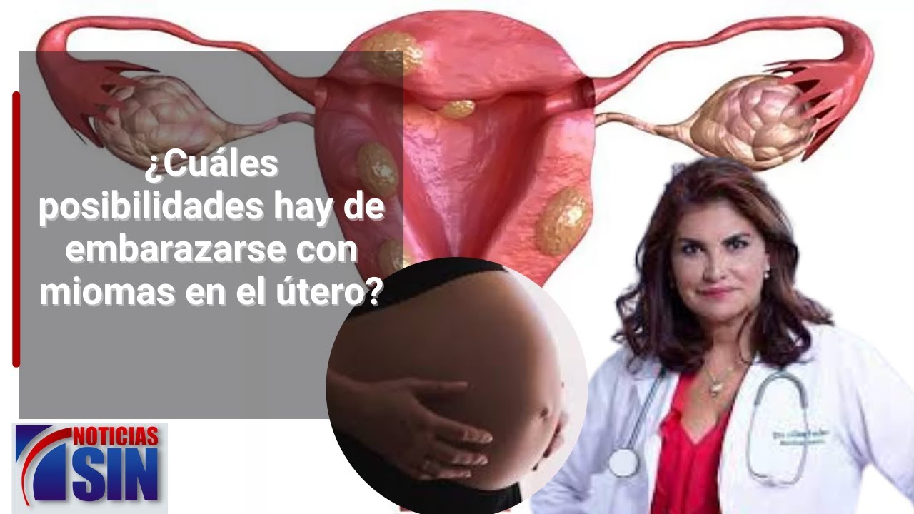 ¿Cuándo se debe extirpar un mioma en el útero ?