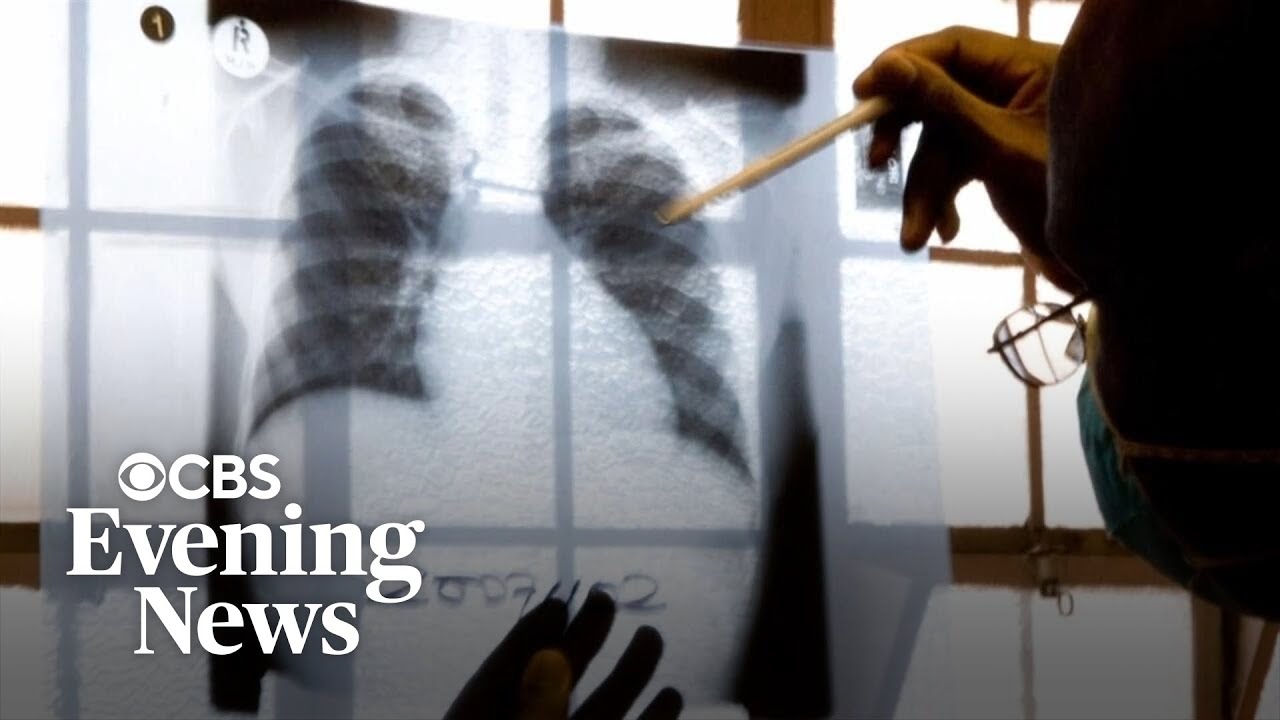 Author John Green explains why "Everything Is Tuberculosis"
