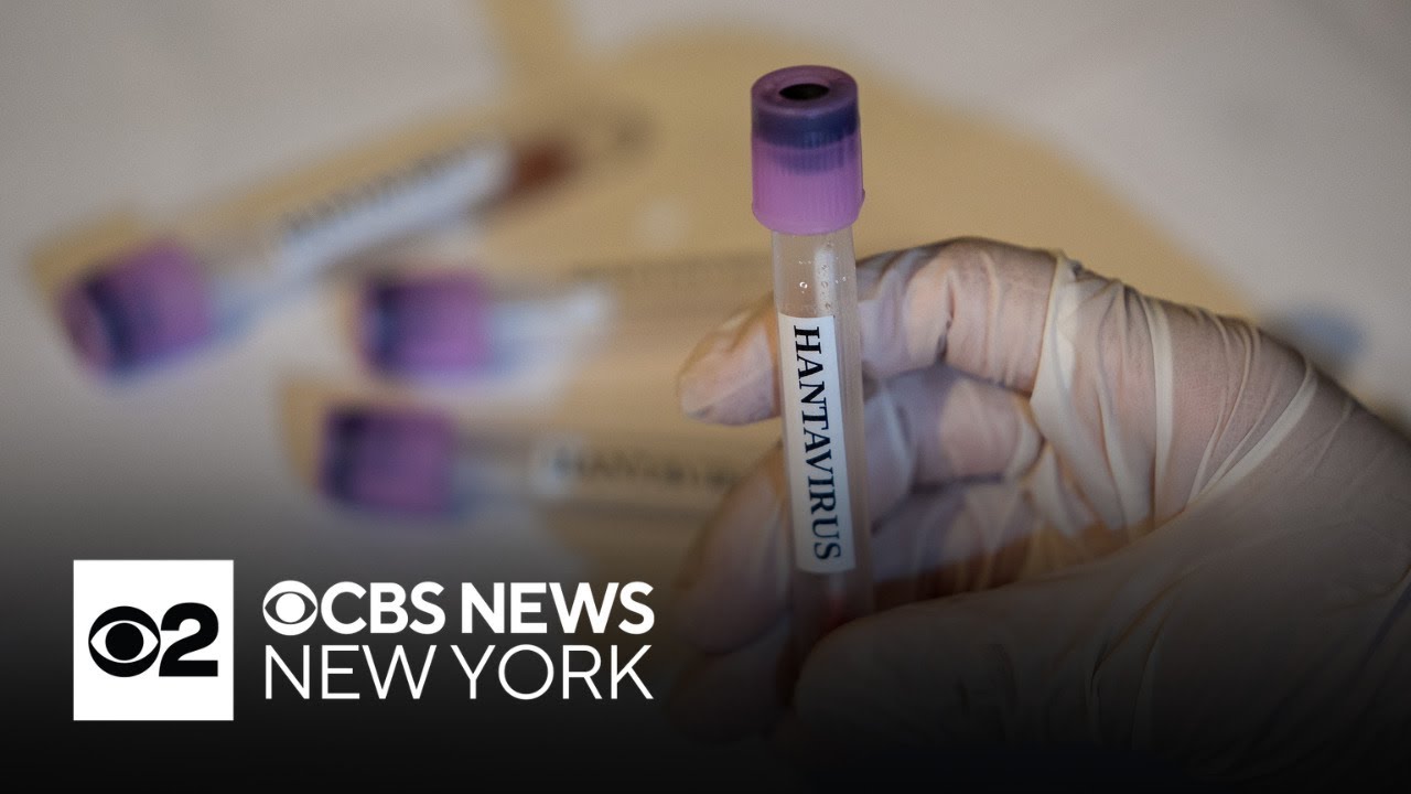 2 New Jersey residents possibly exposed to hantavirus, health officials say