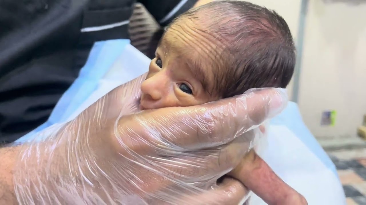 Tiny Premature Miracle Feeding 🍼👶🤍 | Small Baby Big Strength #PreemieStrong #NICUCare 