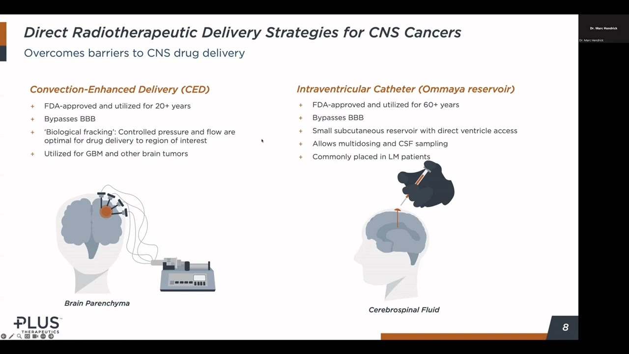 Plus Therapeutic's ReSPECT trial for Glioblastoma