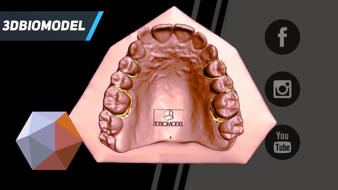 Meshmixer Dental - Preparazione modello per bande ortodontiche