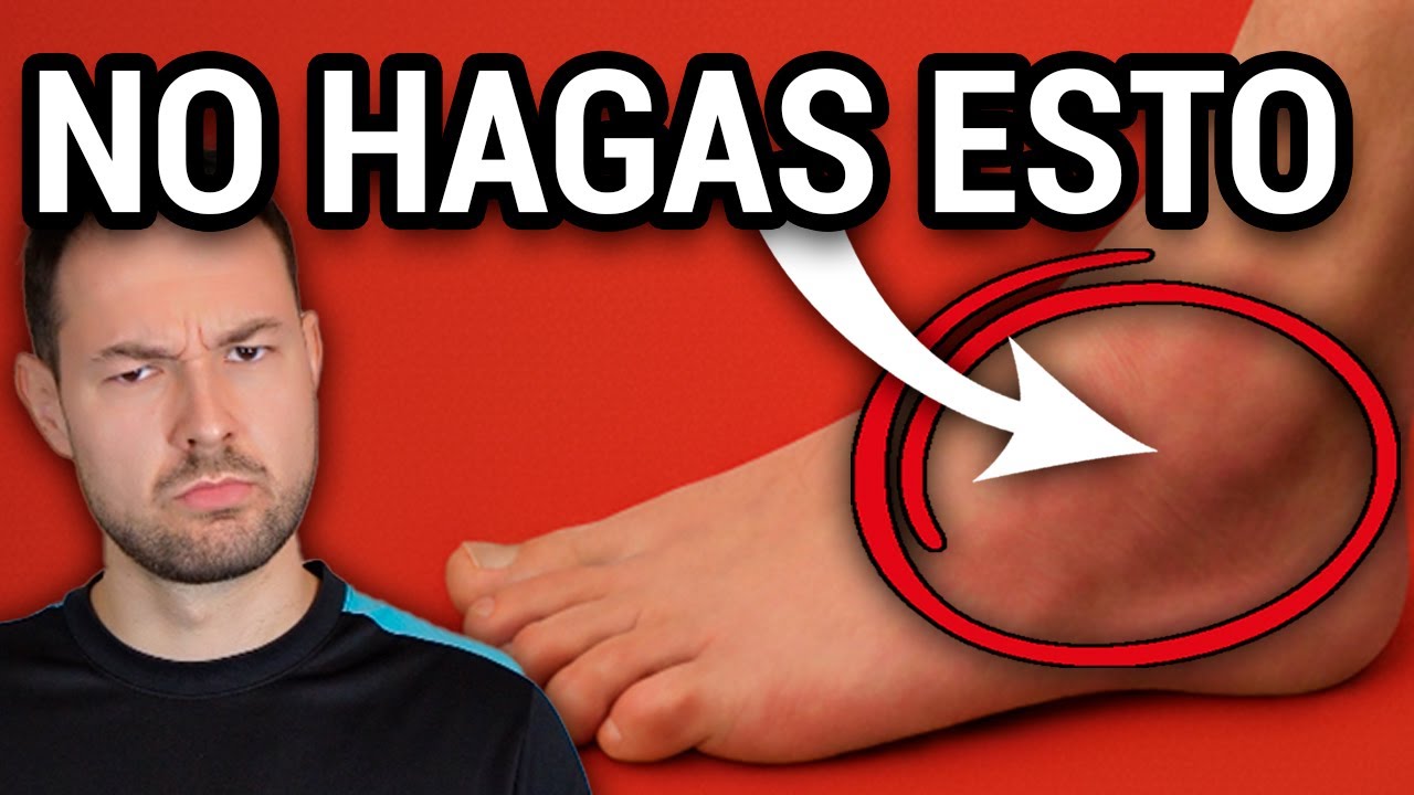 3 ERRORES que COMETES con un ESGUINCE de TOBILLO