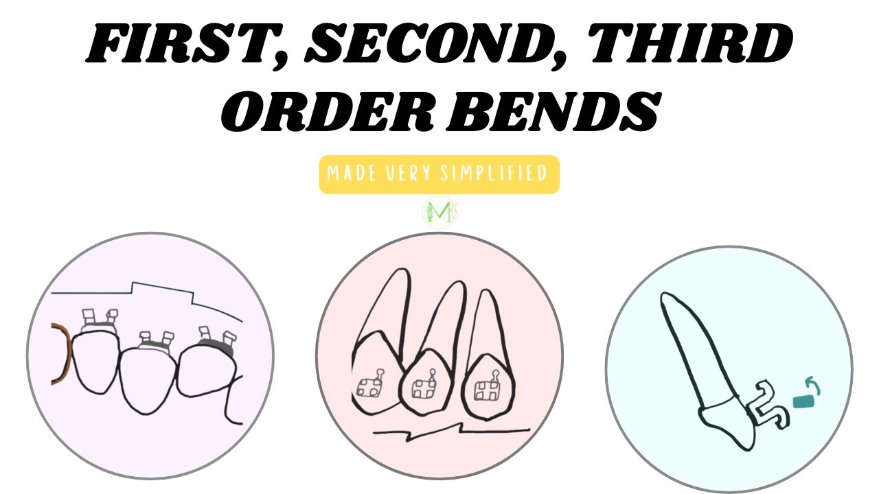 First, Second, third order bends in orthodontics | Medinare