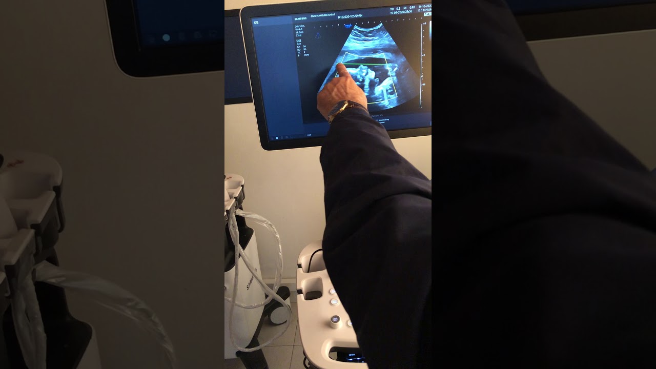 Webinars 7: 3D/4D ajustes y optimización de la imagen.