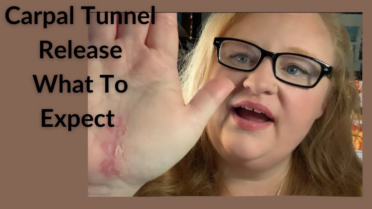 Carpal Tunnel Release Wide Awake Surgery: What To Expect