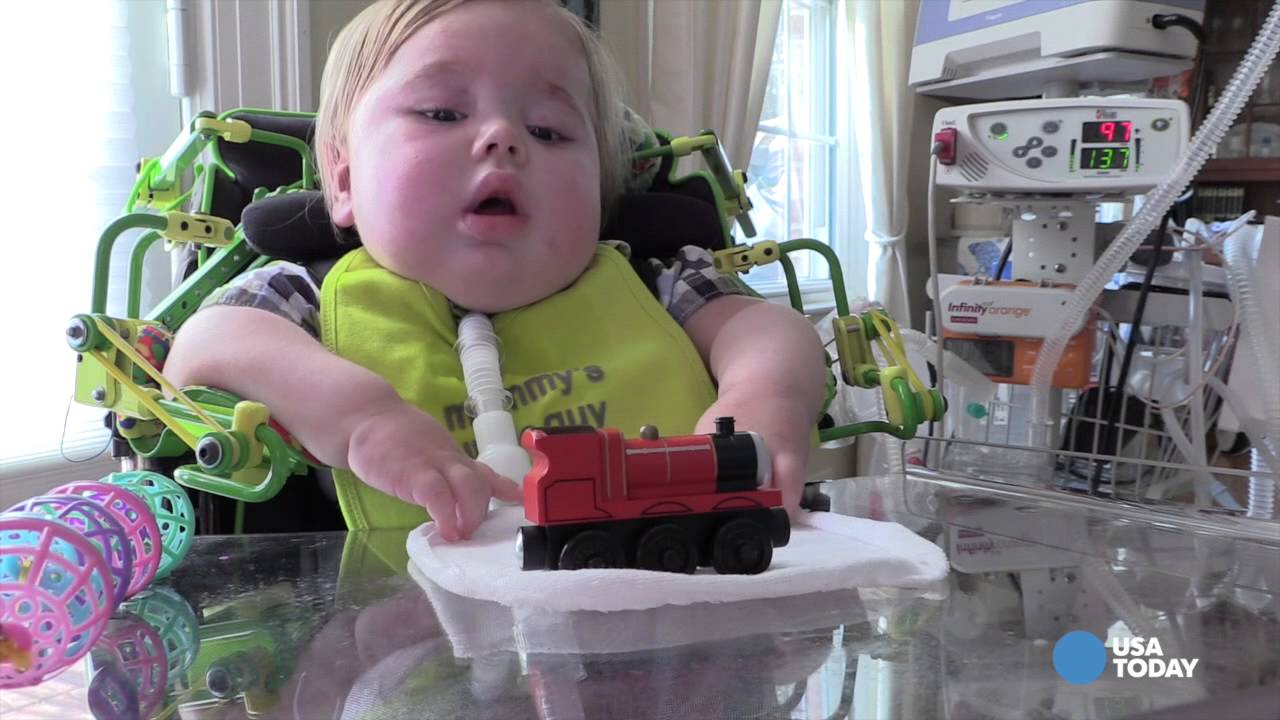 Robotic exoskeleton helps 13-month-old boy