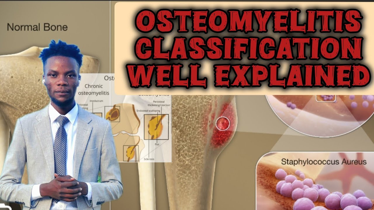 OSTEOMYELITIS (INTRODUCTION AND CLASSIFICATION)