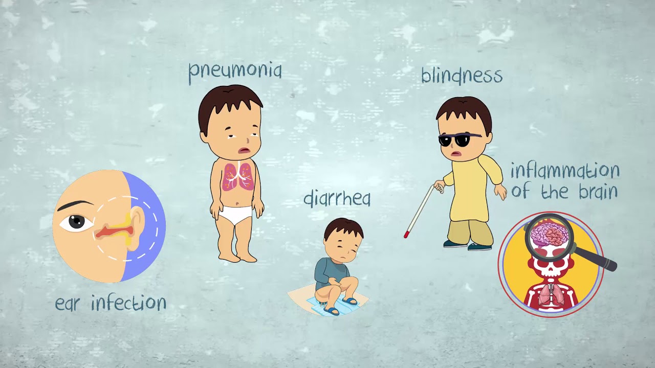 How much do you know about measles?