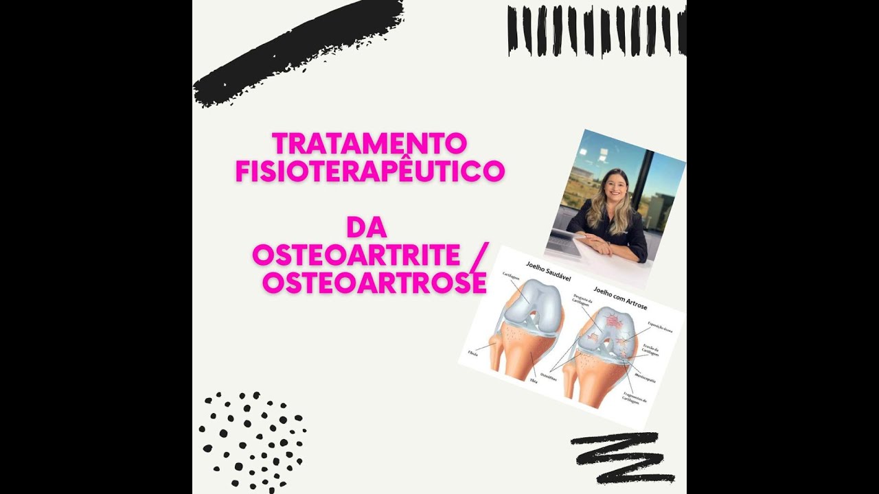 Tratamento fisioterapêutico da osteoartrite (osteoartrose)