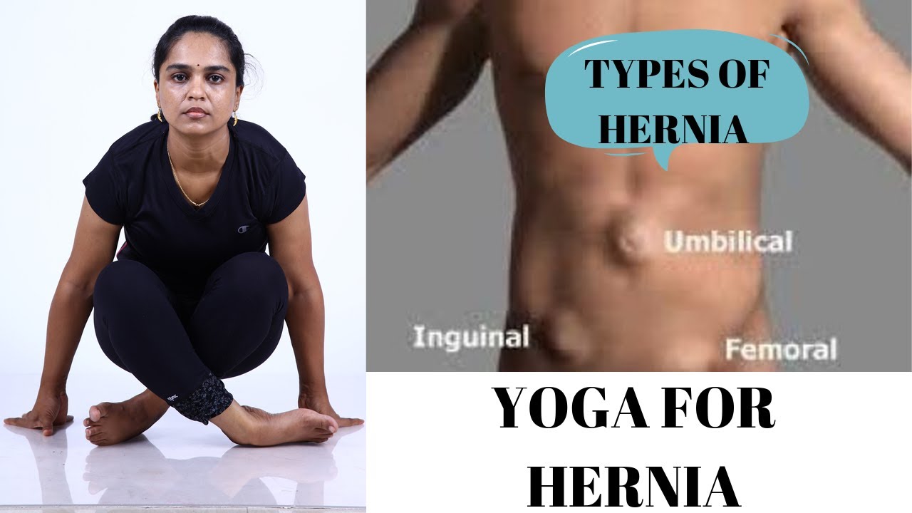 Yoga for umbilical hernia/inguinal hernia/குடலிறக்கத்திற்கான யோக பயிற்சி  tamil Dr.Lakshmi andiappan