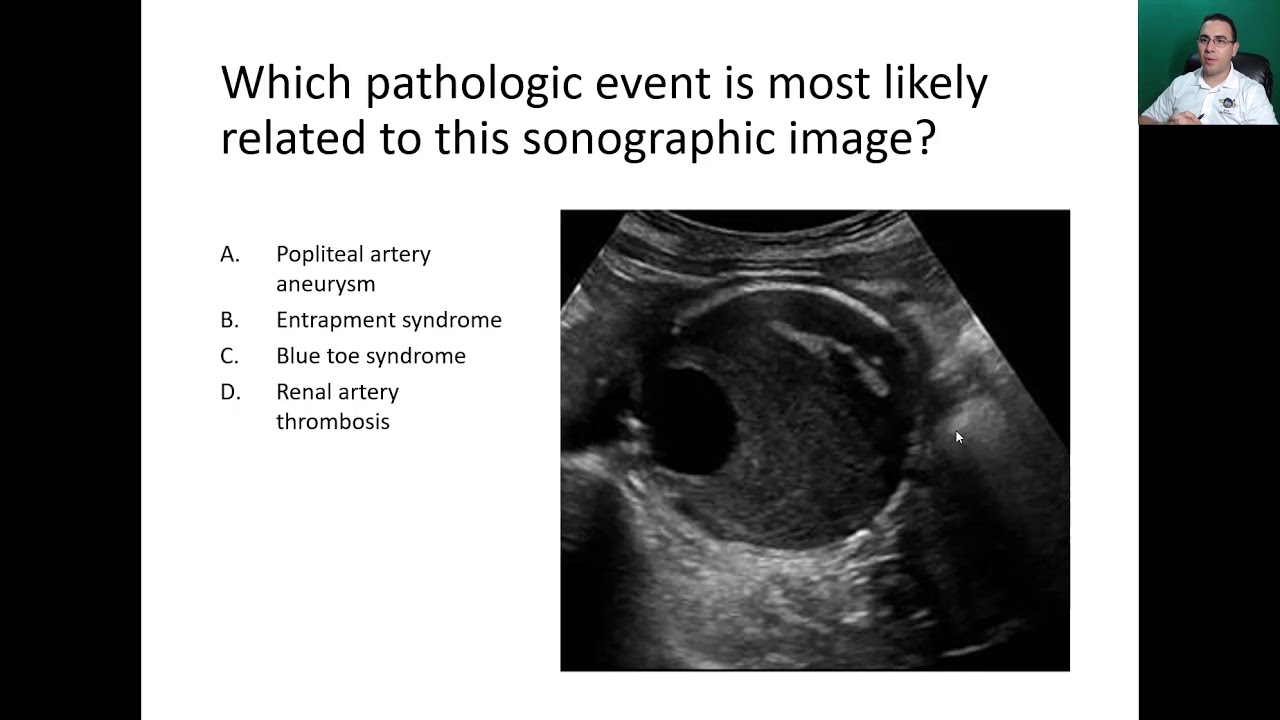 Arterial Questions and Answers