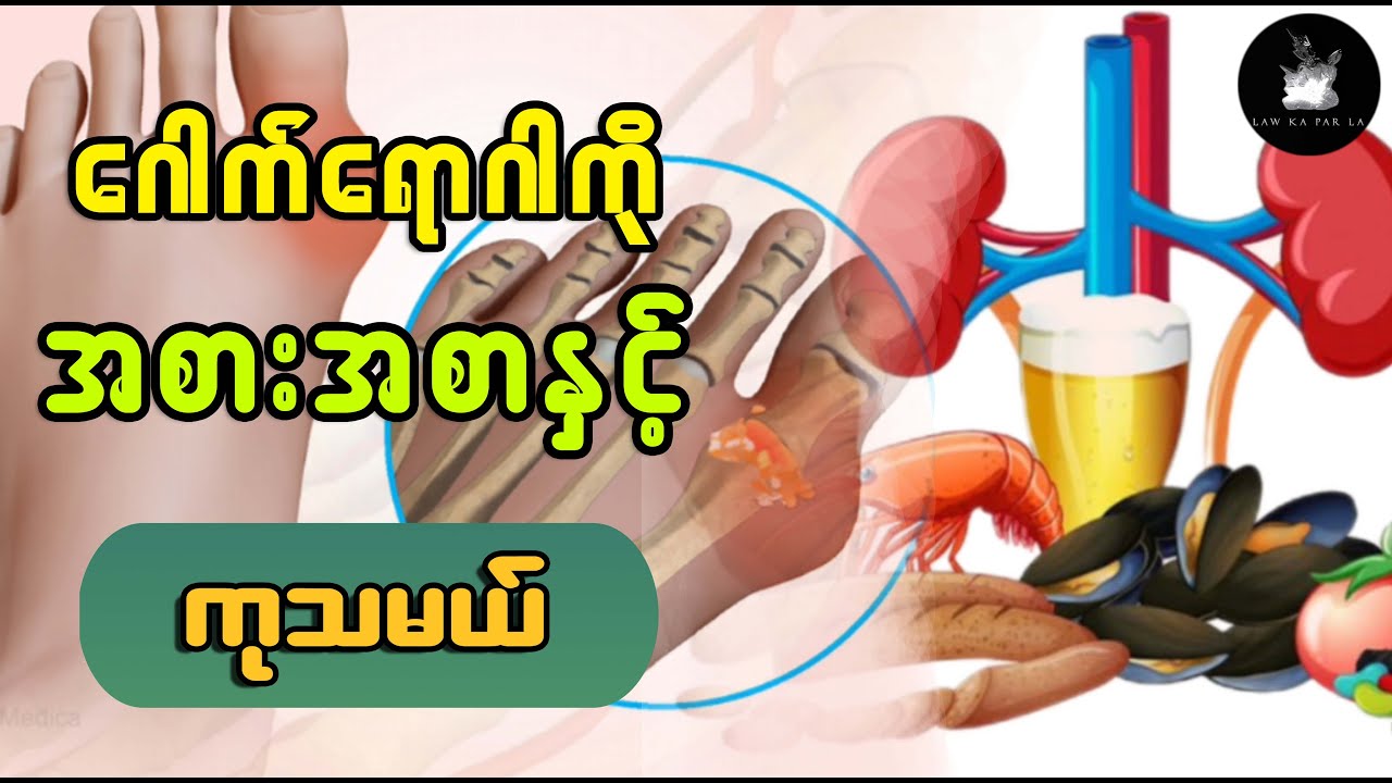 ဂေါက်ရောဂါကို အစားအစာနှင့် ကုသမယ် (ကျန်းမာရေးကဏ္ဍ)