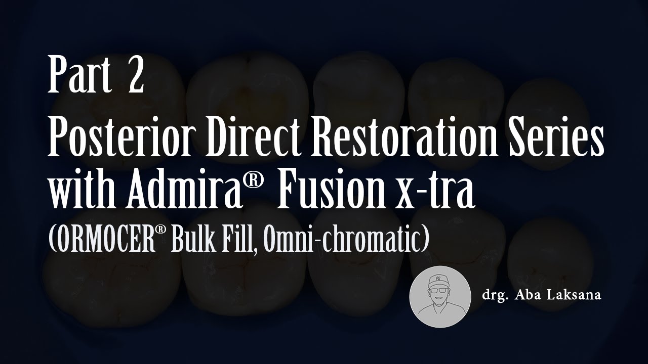 Admira Fusion X-tra, Nano-ORMOCER Bulk Fill Omni-Chromatic Direct Posterior Restoration Single Shade