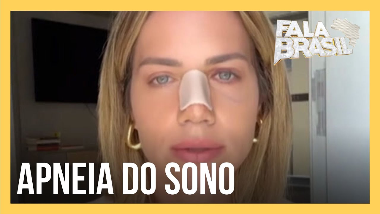 Giovanna Ewbank faz cirurgia no nariz para corrigir desvio de septo