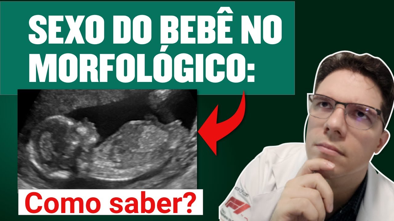 SEXO DO BEBÊ NO ULTRASSOM MORFOLÓGICO DE PRIMEIRO TRIMESTRE: COMO SABER SE É MENINO OU MENINA?