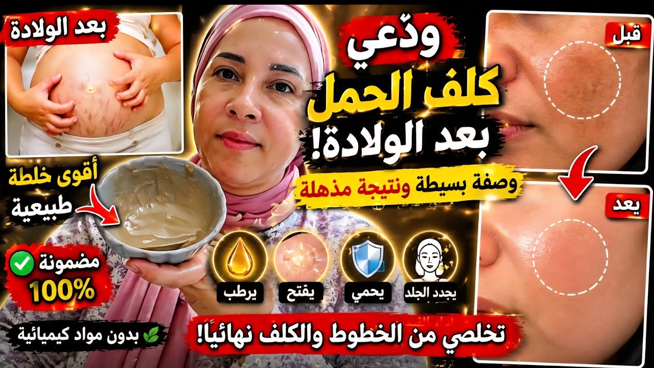 وصفة بسيطة  طبيعية لعلاج  كلف الحمل🤰بعد  الولادة 🤱#وصفات_سهلة #لايك_اشتراك #اكسبلور 