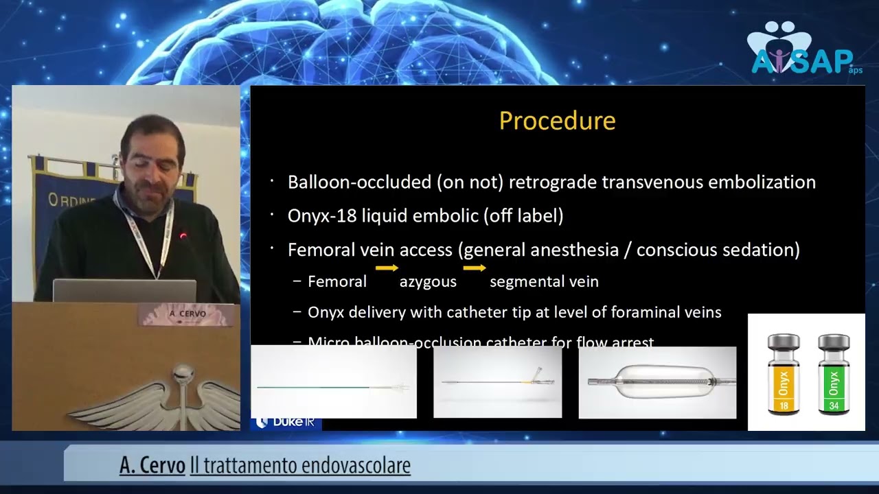 A. Cervo Il trattamento endovascolare