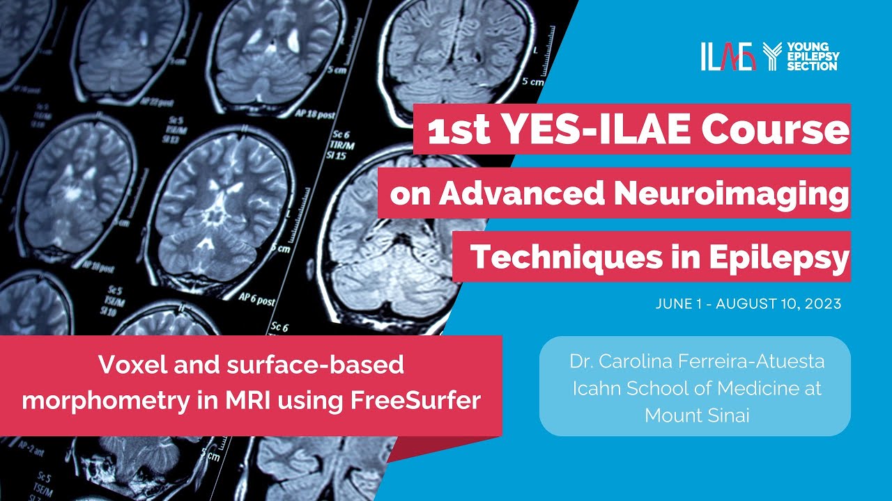 4th Lecture Surface-based morphometry in MRI using FreeSurfer