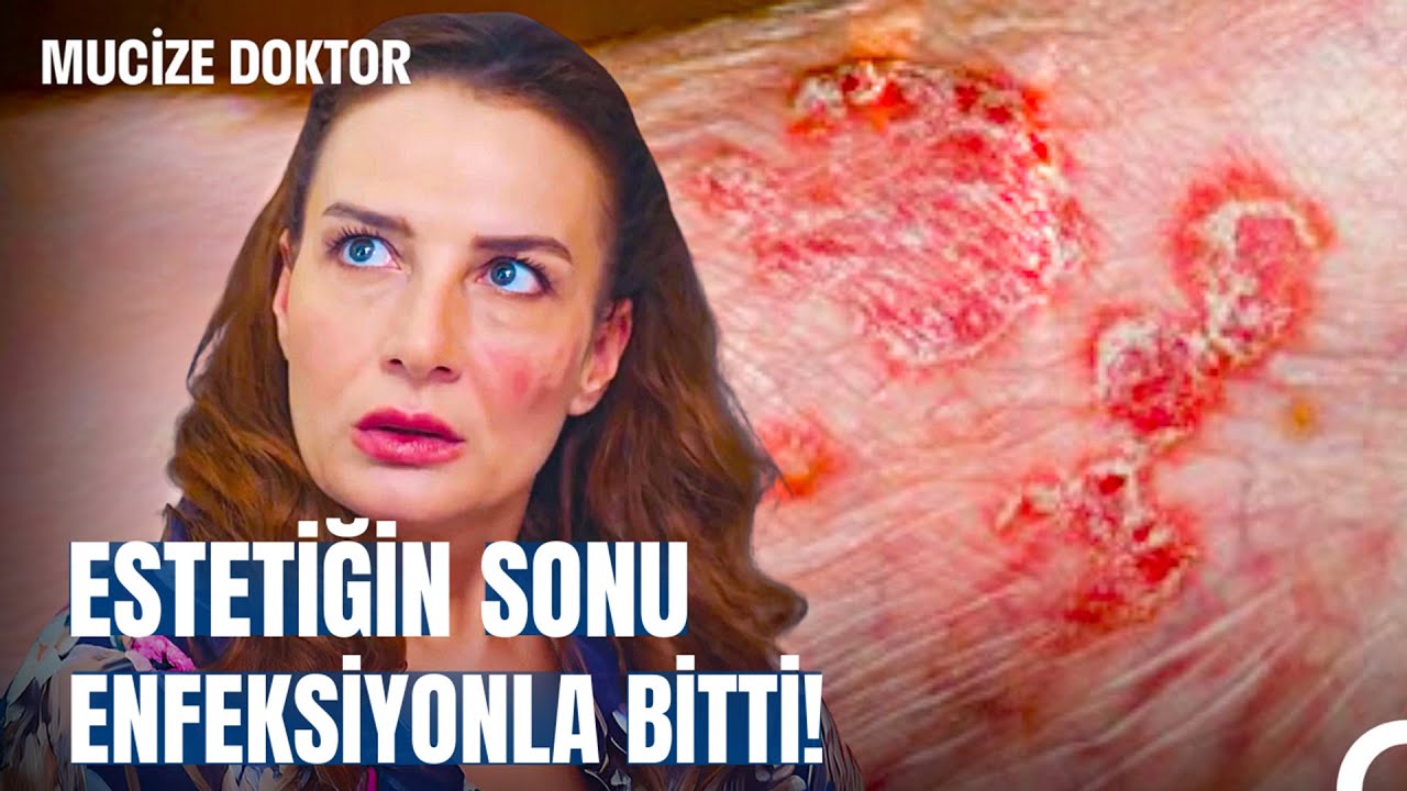 İçimdeki Canavarlar | Aşkı İçin Estetikten Vazgeçmedi! - Mucize Doktor