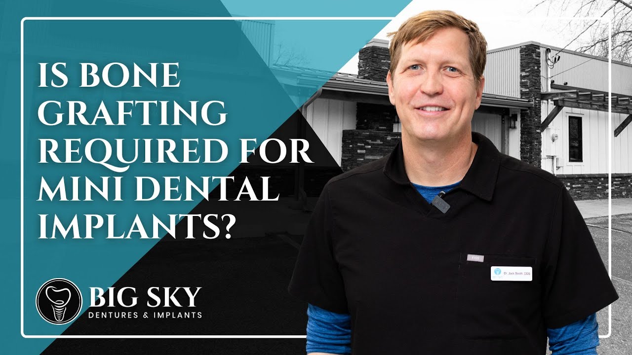 Is Bone Grafting Required for Mini Dental Implants? | Dental Implants in Missoula, MT