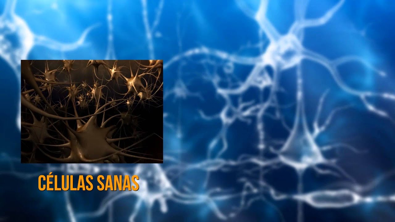 ¿Cómo ayudar al cerebro a repararse y reconectarse después de un accidente cerebrovascular?