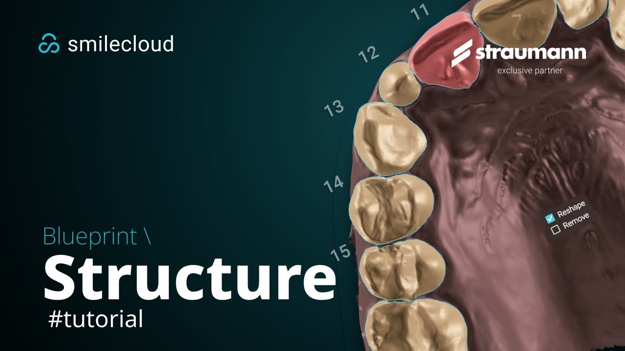 Blueprint - Structure