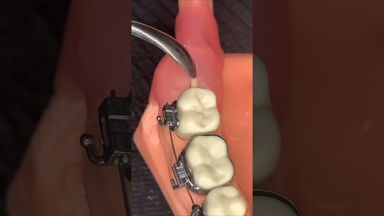 Amazing dentist #teeth #shorts