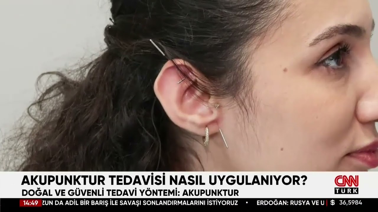 Akupunktur tedavisi nasıl yapılır? Dr. Uğur Nedim YÜCE