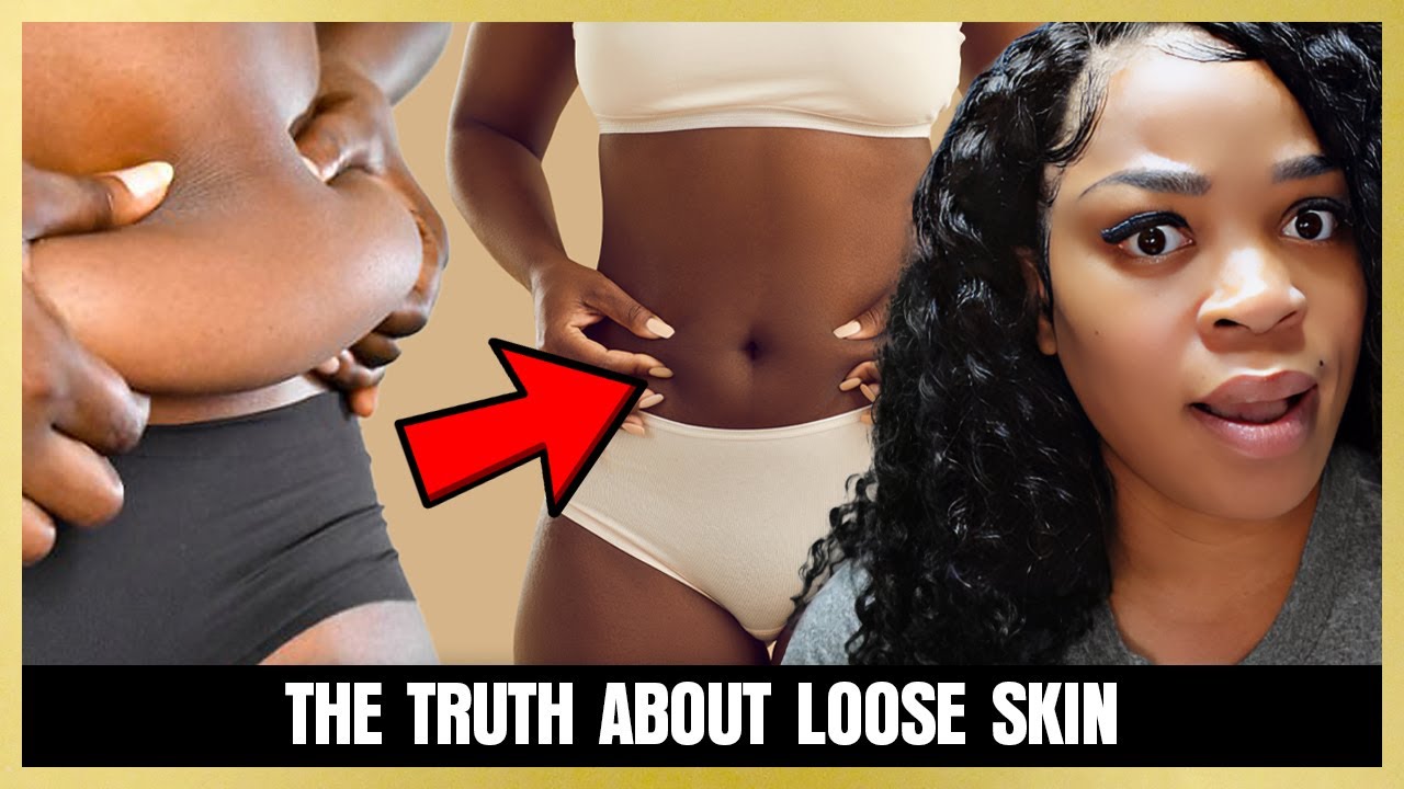 20lbs in 7 days 🔥 how I reduced loose skin after weight loss | how to get rid of loose skin