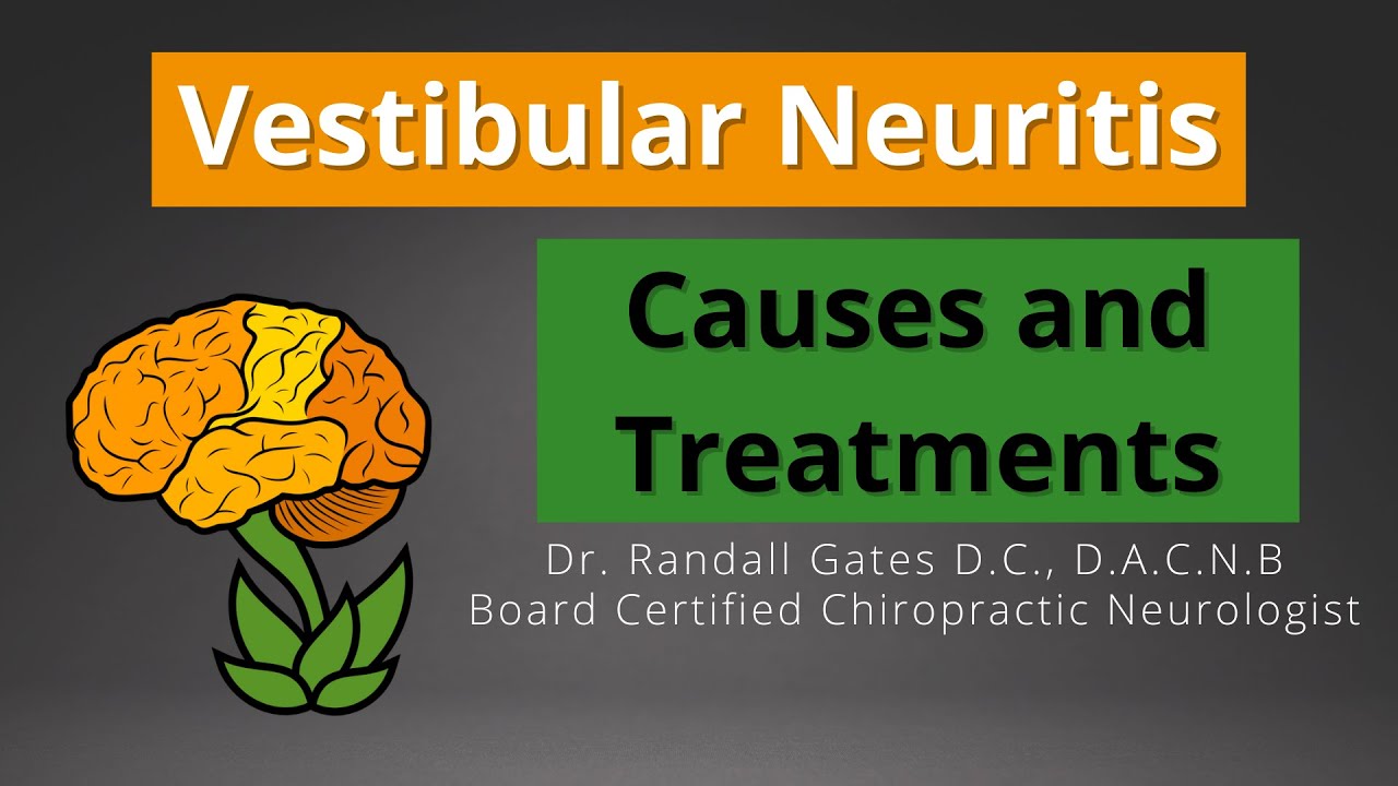 Vestibular Neuritis: Causes and Treatment