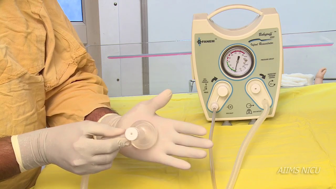 CPAP in delivery room using T Piece