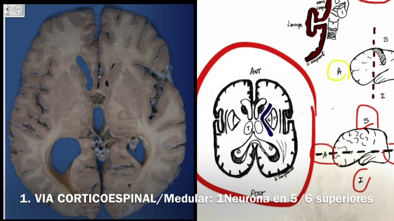 Neuroanatomía Tp5: Vía piramidal