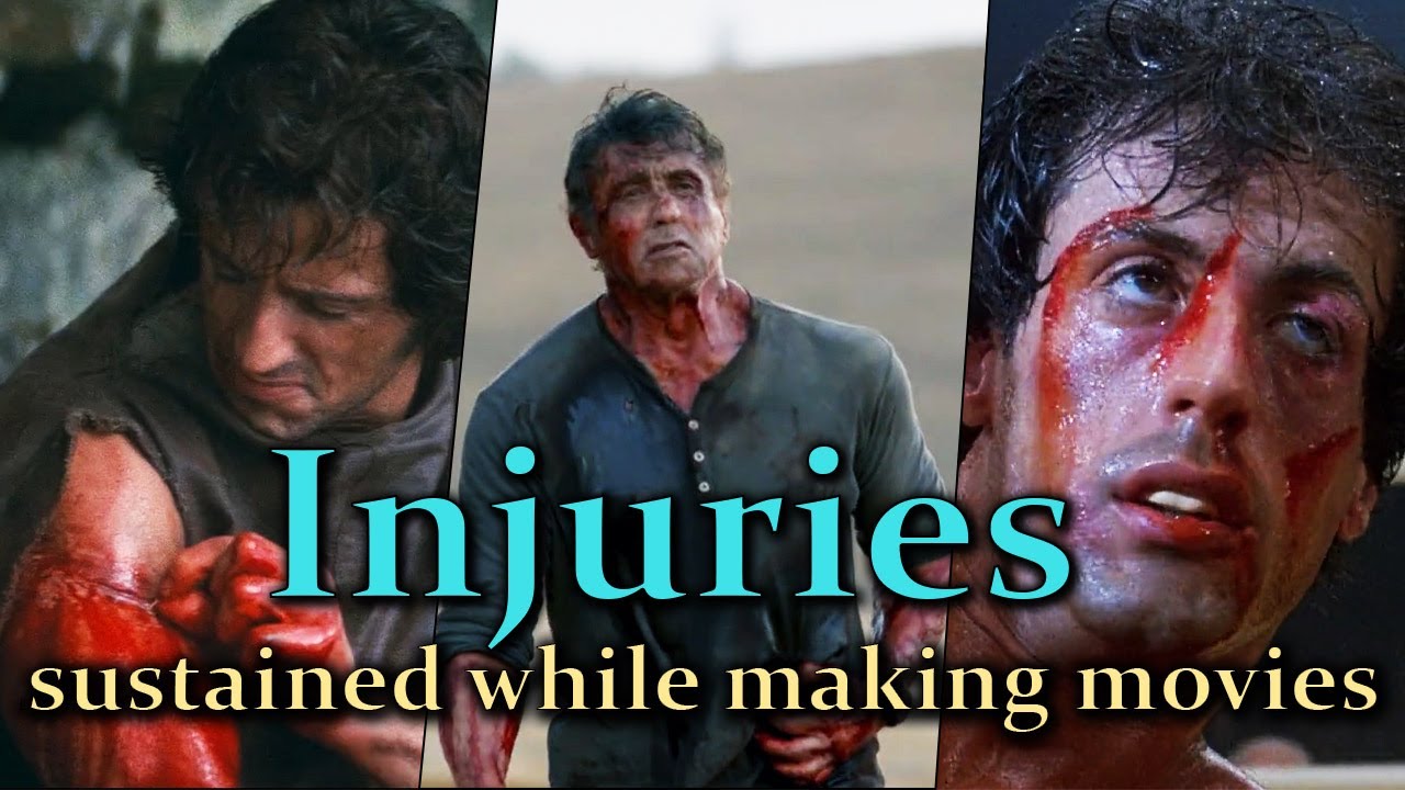 Sylvester Stallone - Injuries sustained while making movies