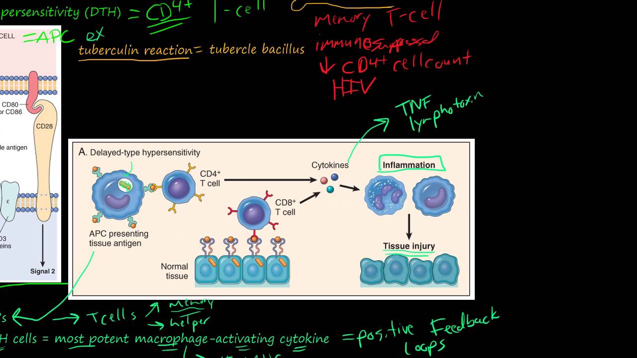 81P- Delayed-Type Hypersensitivity, T-Cell-Mediated (Type IV) Hypersensitivity