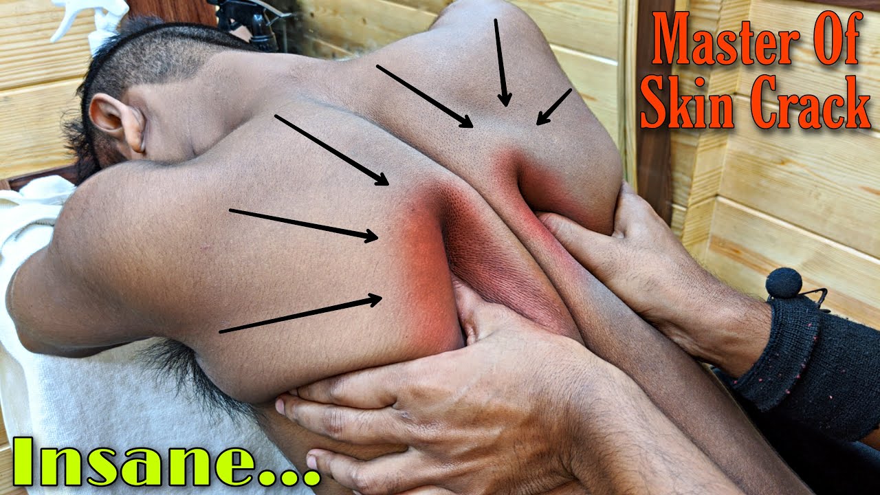 Insane Body Massage by Master of skin Crack / Neck & Skin Crack Compilation | ASMR